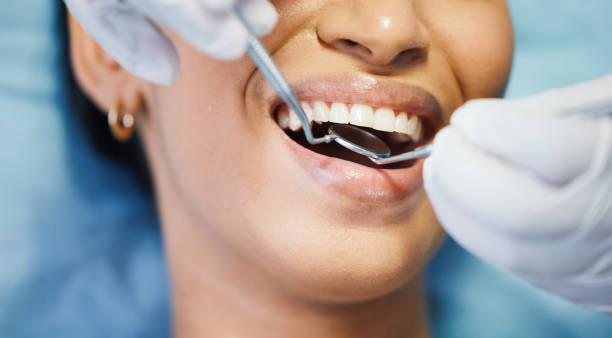 Best Emergency Dentist for Lost Fillings or Crowns in Quinnipiac University, CT