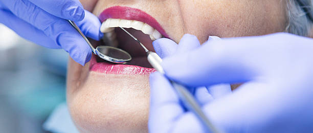 Best Broken or Cracked Tooth Emergency Dentist in Quinnipiac University, CT